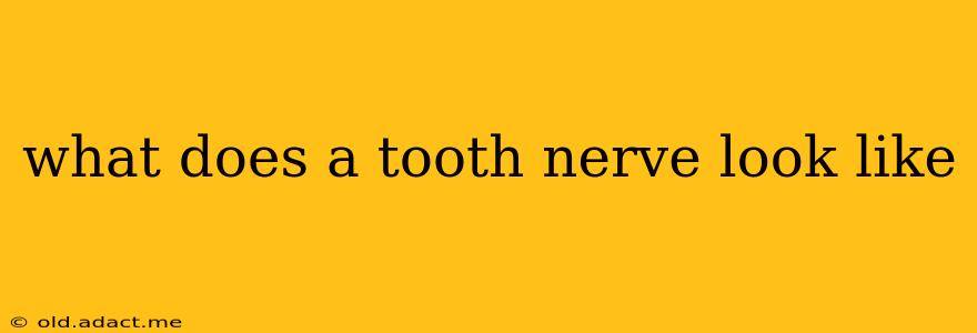 what does a tooth nerve look like
