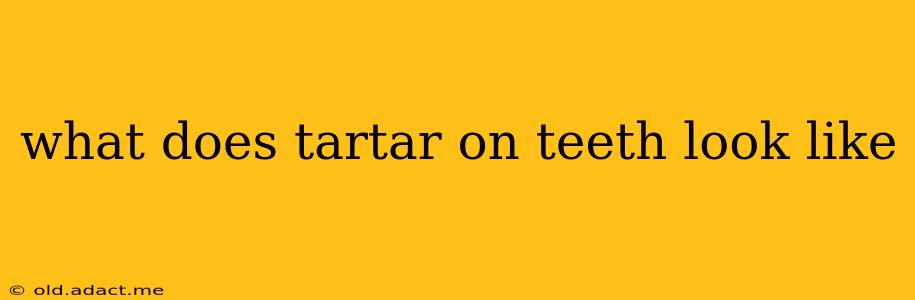 what does tartar on teeth look like