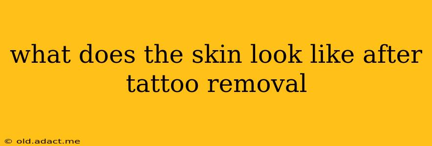 what does the skin look like after tattoo removal