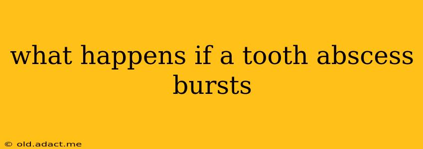 what happens if a tooth abscess bursts