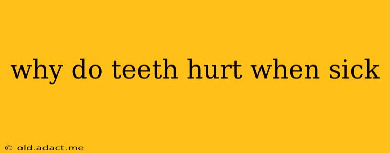 why do teeth hurt when sick