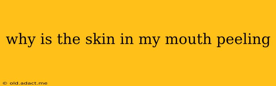 why is the skin in my mouth peeling