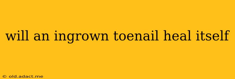 will an ingrown toenail heal itself