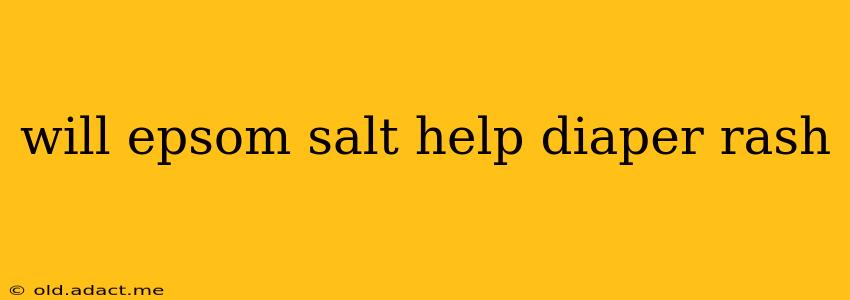 will epsom salt help diaper rash