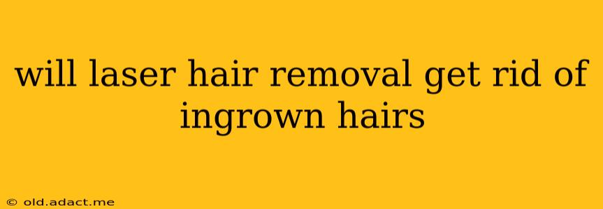 will laser hair removal get rid of ingrown hairs