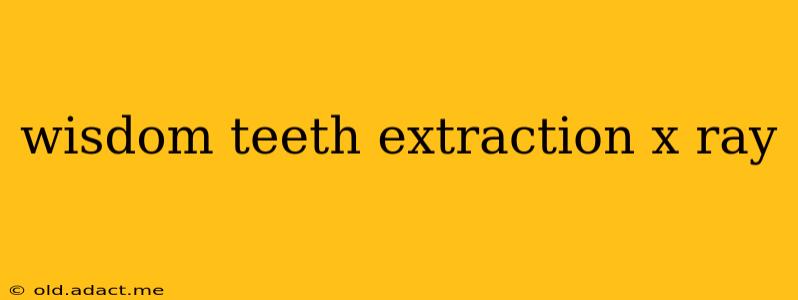 wisdom teeth extraction x ray