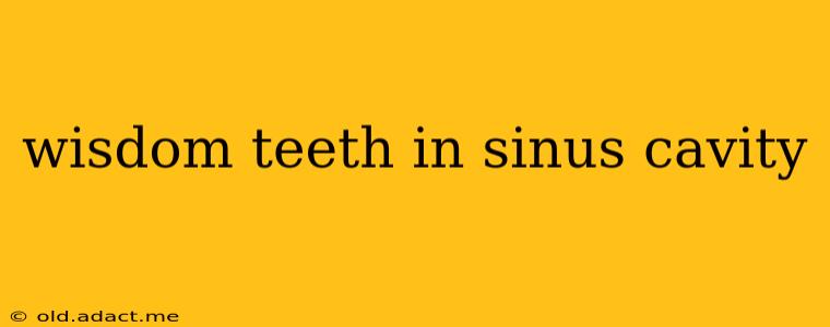 wisdom teeth in sinus cavity
